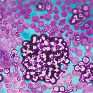 T Cell Activation/Expansion kit, human