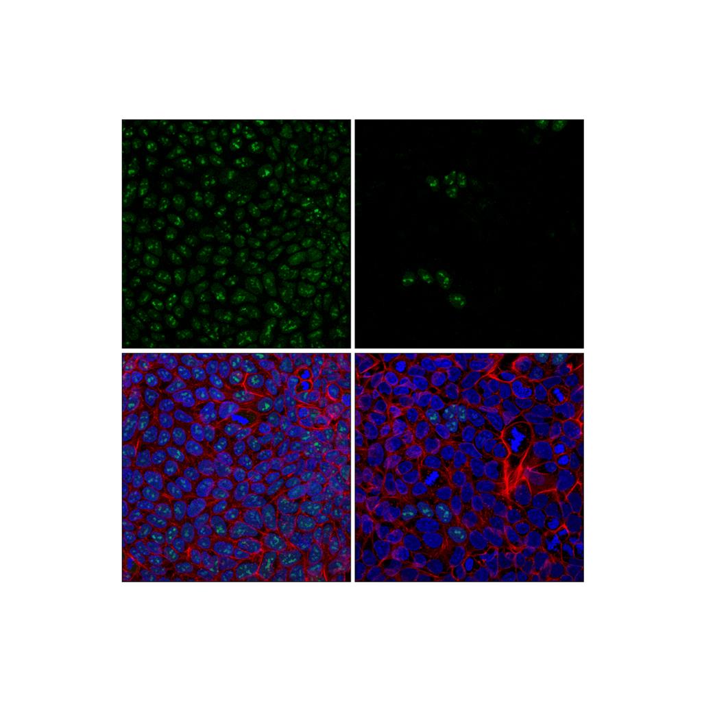 WRN (8H3) 小鼠单克隆抗体