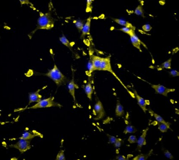 兔脑膜成纤维细胞