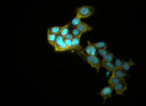 MFC小鼠胃癌细胞