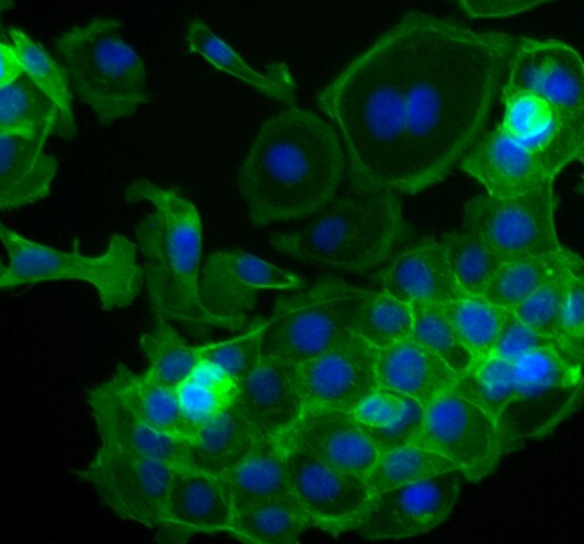 兔肾成纤维细胞