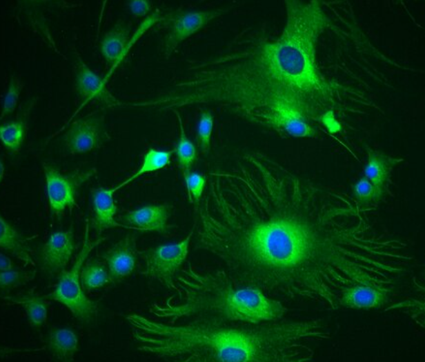 兔海绵体内皮细胞