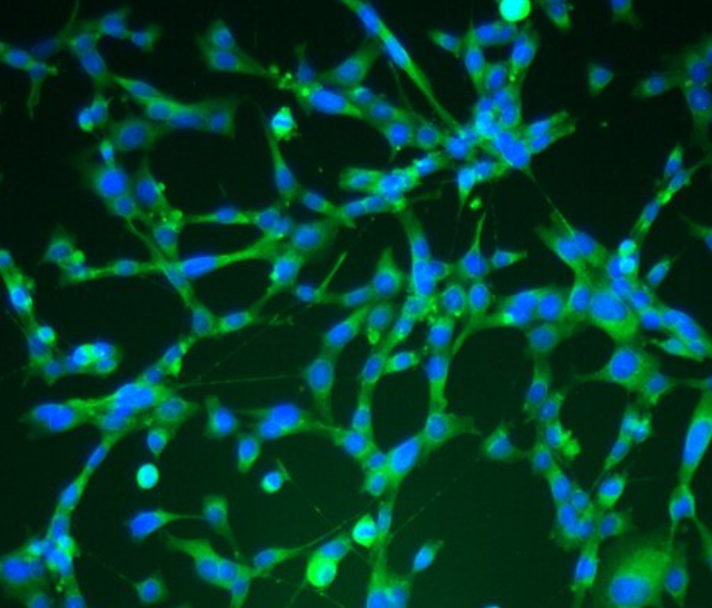 兔肾小球上皮细胞