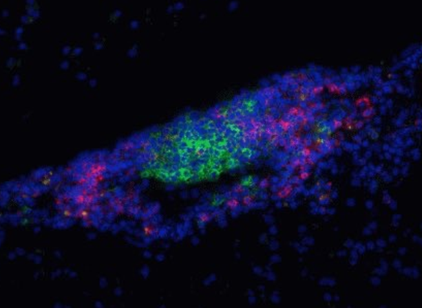 2BS人二倍体细胞/人胚肺成纤维细胞