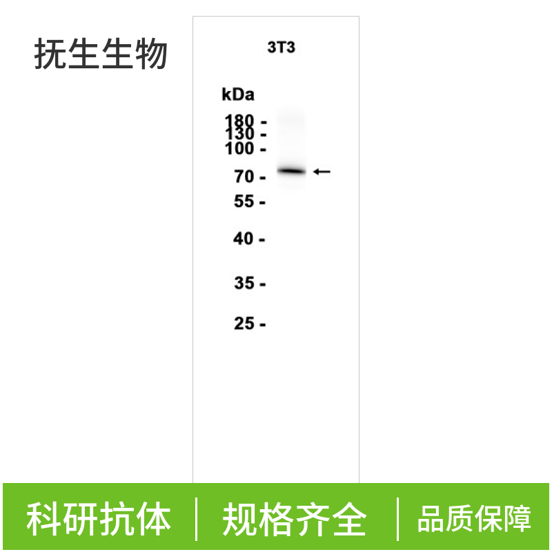 低密度脂蛋白受体相关蛋白1抗体