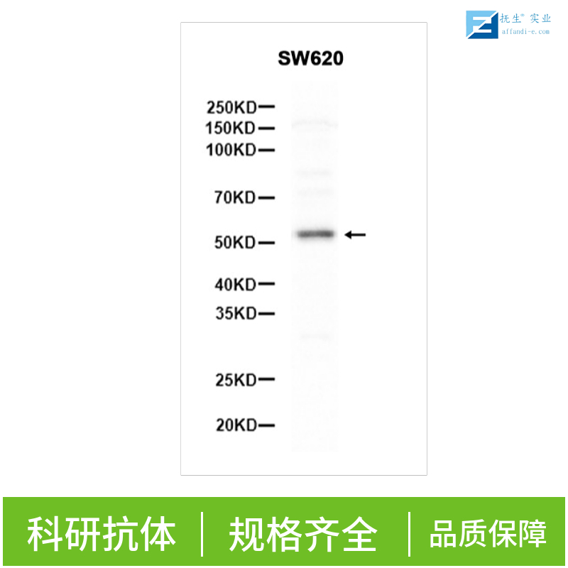 多药耐药蛋白/P-糖蛋白抗体
