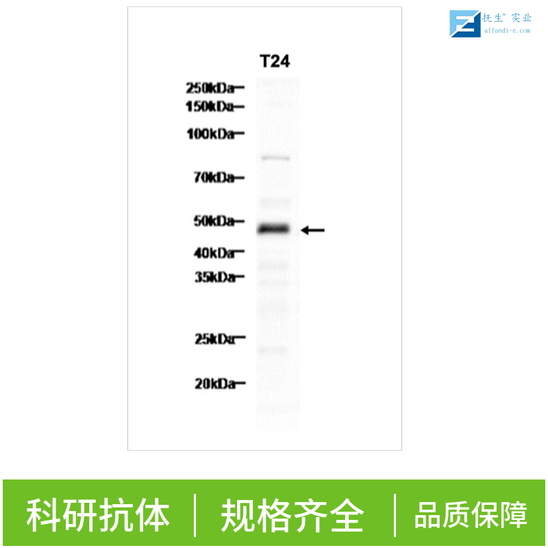 肥大细胞类胰蛋白酶抗体
