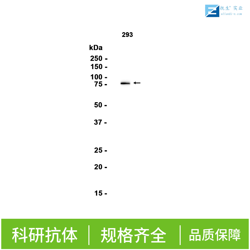 纺锤体和着丝粒相关蛋白1抗体