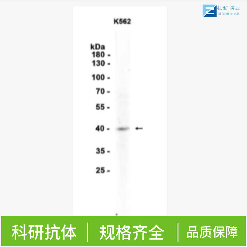 高迁移率族蛋白A1抗体