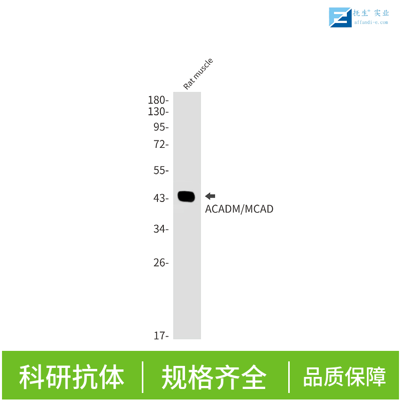 孤儿核受体蛋白Nur77抗体