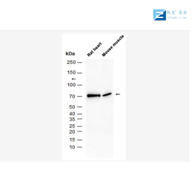 磷脂酶A2受体1抗体