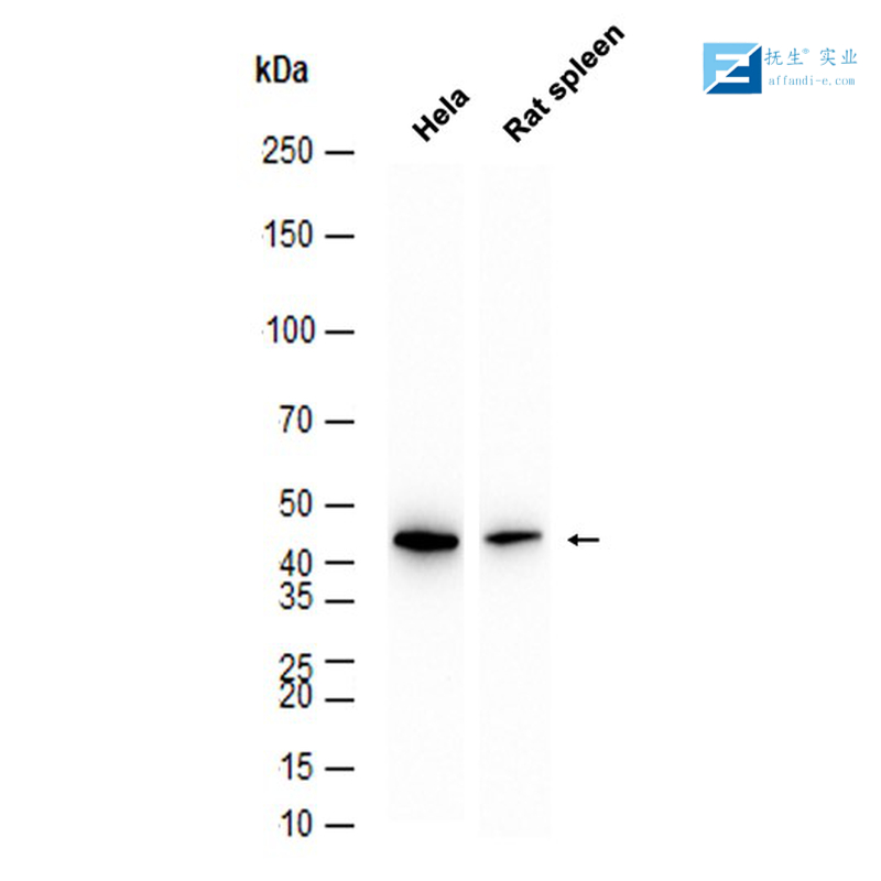 钠通道蛋白10α抗体
