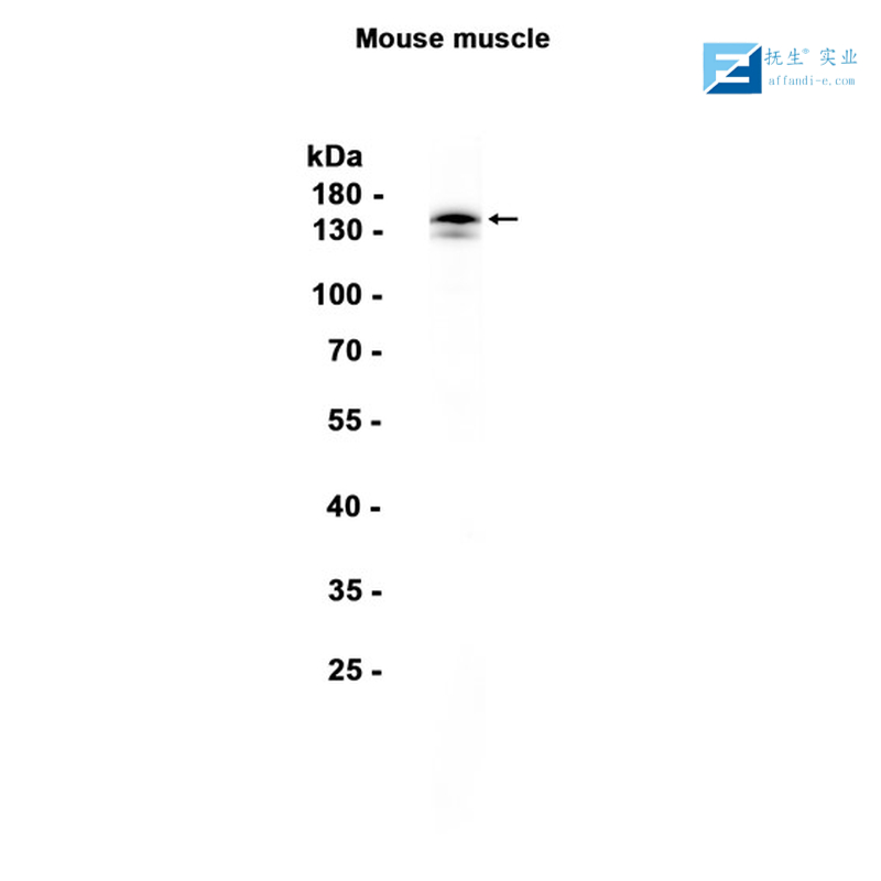 热休克蛋白-70抗体