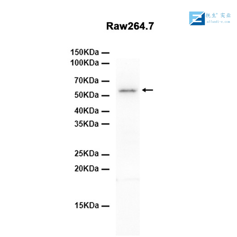 葡萄糖转运蛋白4抗体