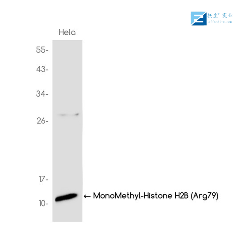 人乙型肝炎表面抗原单克隆抗体（检测）
