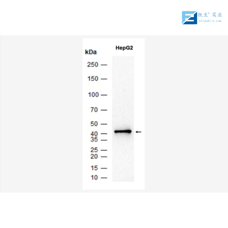 神经损伤诱导蛋白1抗体