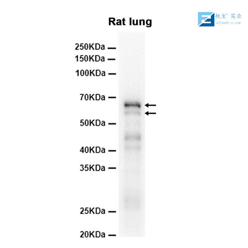钠钾ATP酶通道蛋白抗体