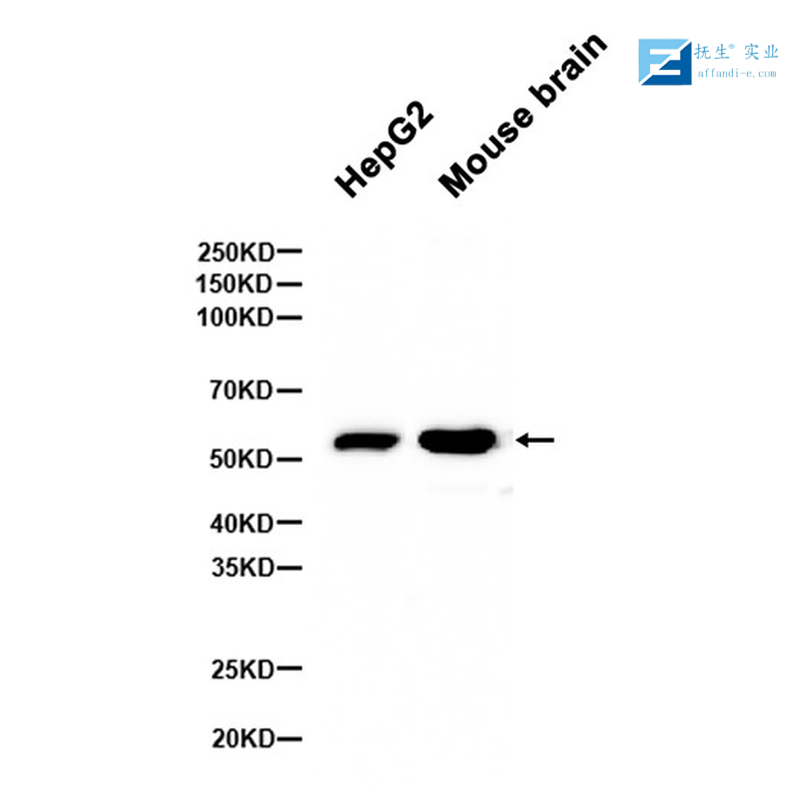 果蝇肌动蛋白（内参）抗体