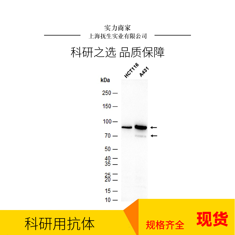 神经肽S受体1/G蛋白偶联受体154抗体