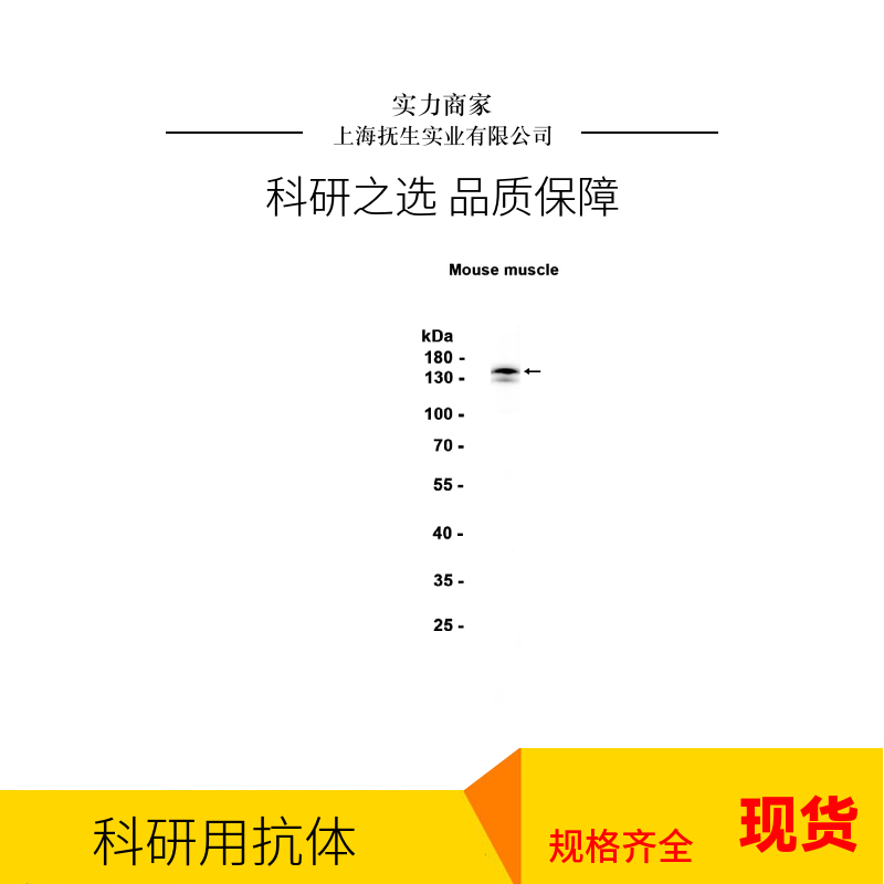 神经元抑制蛋白抗体