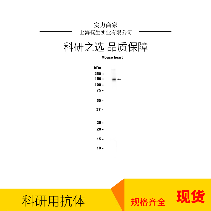 维甲酸相关孤儿受体γt抗体