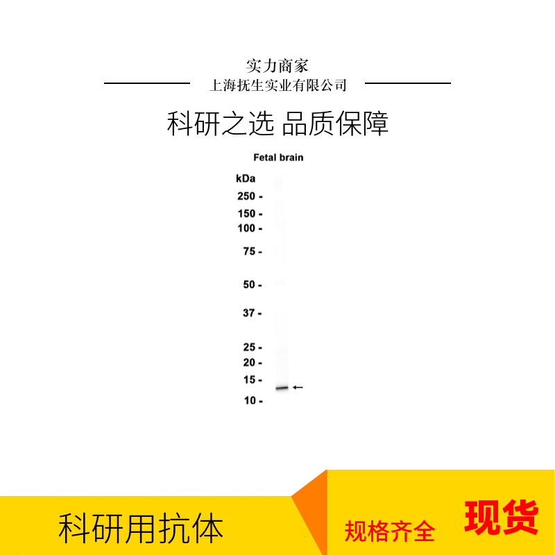 水通道蛋白8抗体