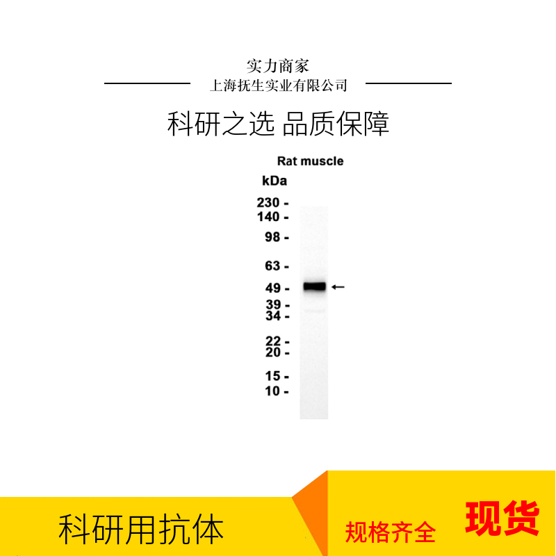 细胞S期激酶相关蛋白2抗体