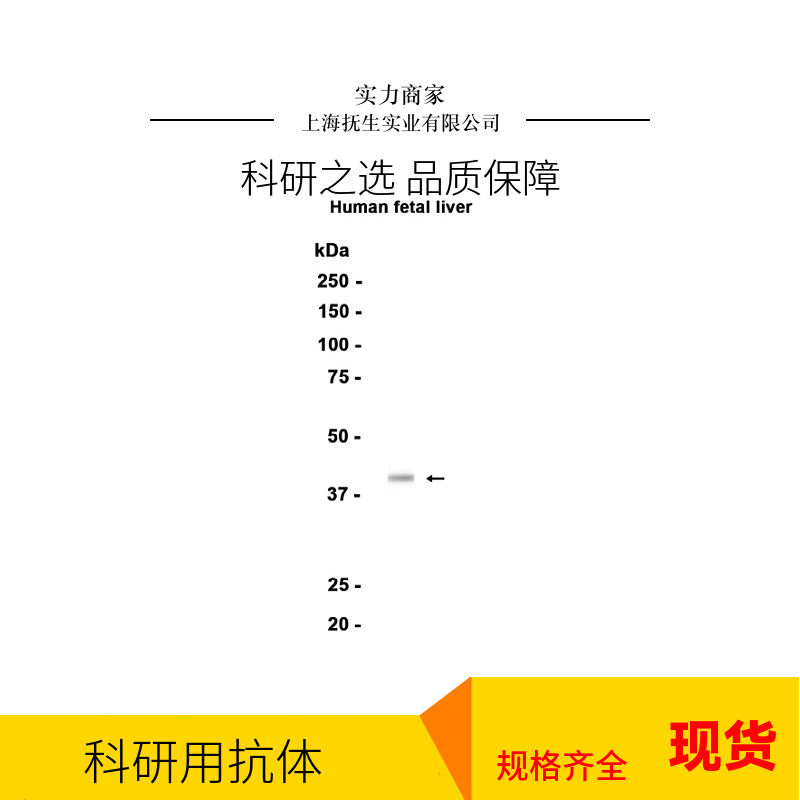 细胞色素P450 11B1抗体