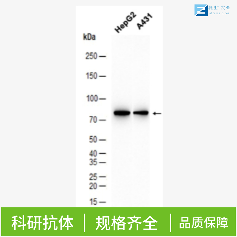 胰岛素样生长因子结合蛋白5抗体