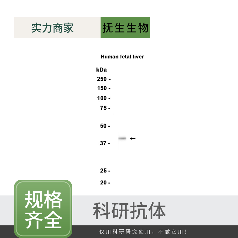 脂蛋白磷脂酶A2抗体