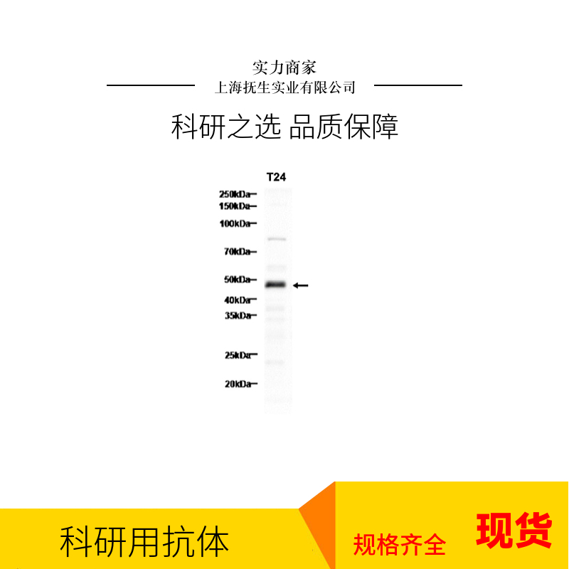 雄激素受体（AR）抗体