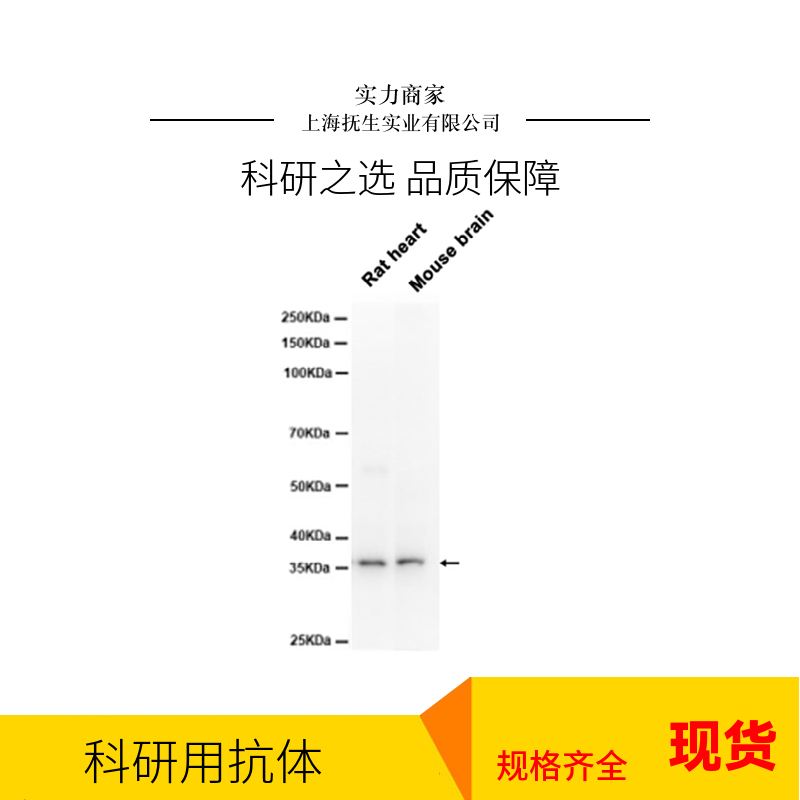 乙酰辅酶A羧化酶重组兔单抗