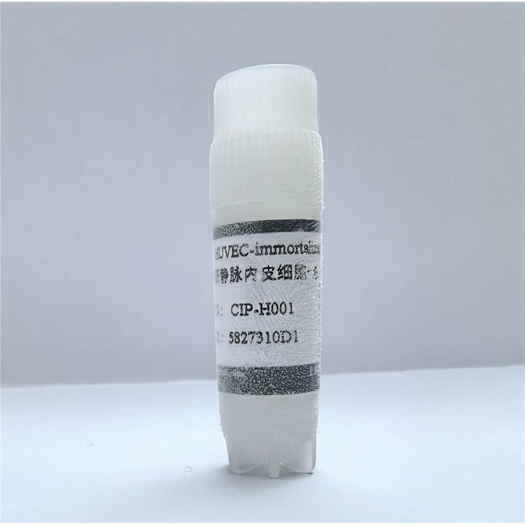 人脐静脉内皮细胞-永生化