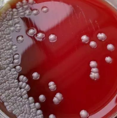 Altererythrobacter Epoxidivorans