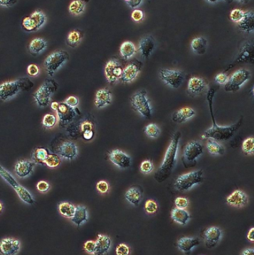 Ferruginibacter Lapsinanis