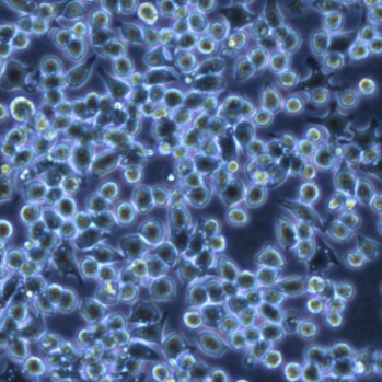 Hymenobacter Yonginensis