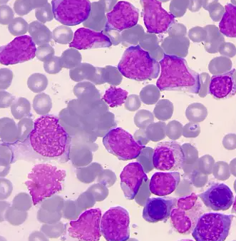 Pelagerythrobacter Aerophilus