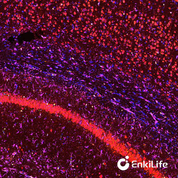 TSA六标七色多重荧光染色试剂盒（mIHC）