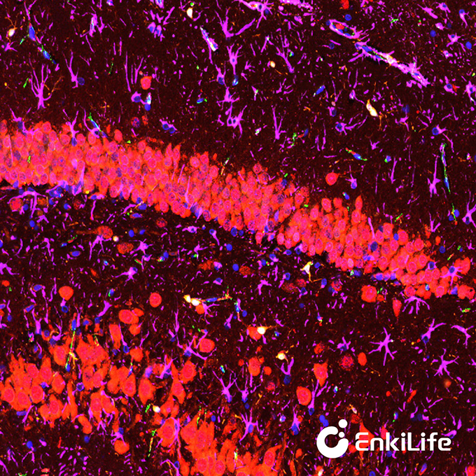 TSA六标七色多重荧光染色试剂盒（mIHC）