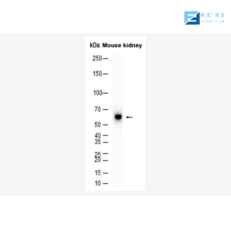 磷酸化糖原合酶激酶3β抗体
