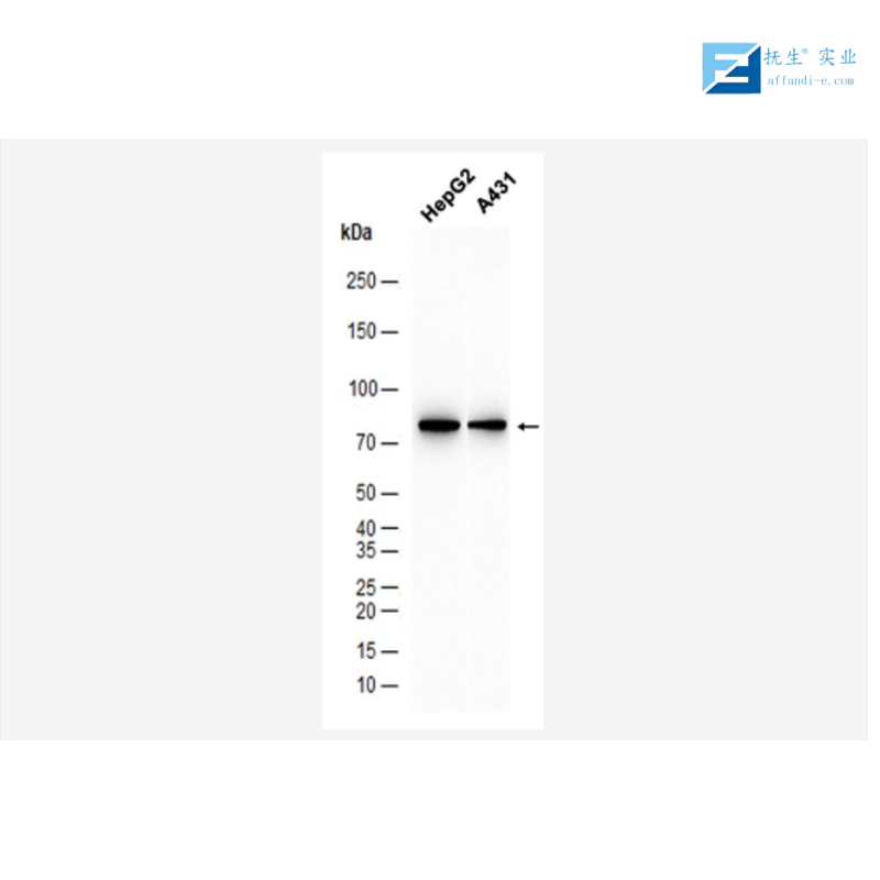 磷酸化丝氨酸抗体
