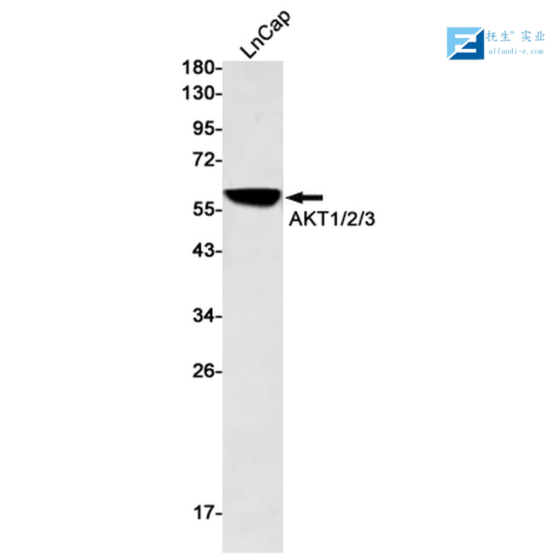 磷酸化磷脂酰肌醇激酶/PI3 Kinase P85α/γ抗体