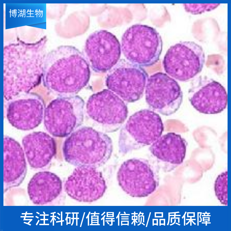 HCC1143人乳腺癌细胞
