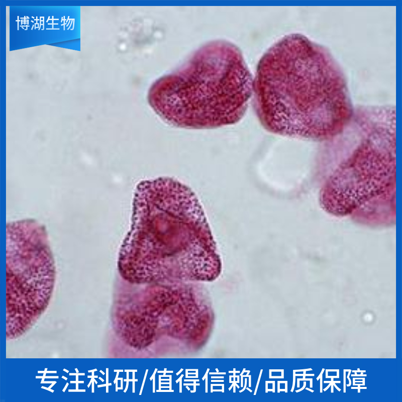 CCF-STTG1 人脑星形胶质细胞瘤