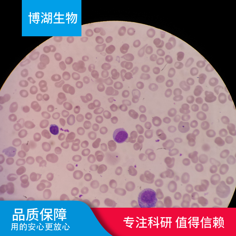 CCD-1069Sk人乳腺浸润性导管癌旁皮肤细胞