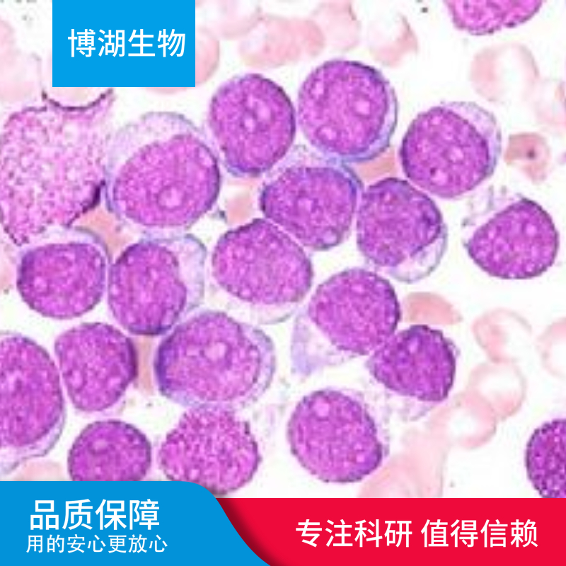 CMK-11-5急性髓性白血病细胞