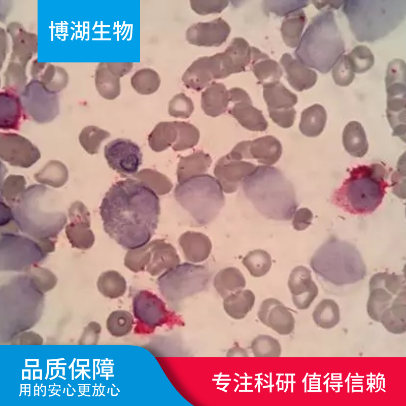 CMK-11-5急性髓性白血病细胞