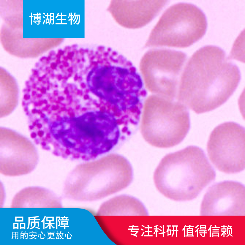 CMK-11-5急性髓性白血病细胞