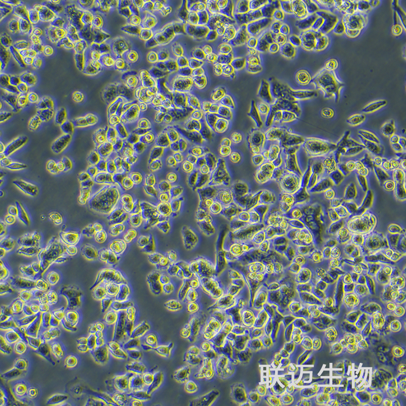AsPC-1细胞（转移胰腺腺癌细胞STR鉴定正确）LM8C0027