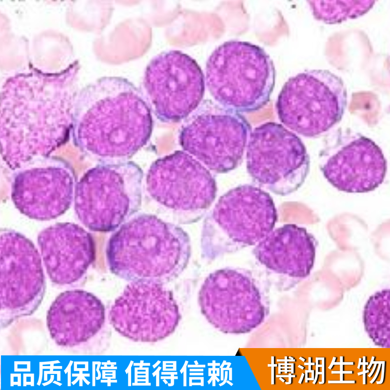 Ca Ski人子宫癌细胞